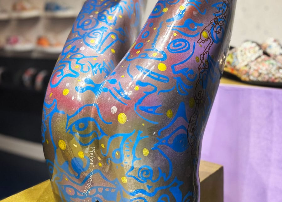 billen ass AIN anuskanker