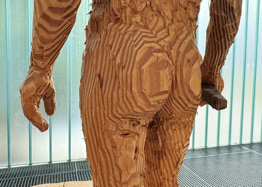 billen kont ass AIN anuskanker