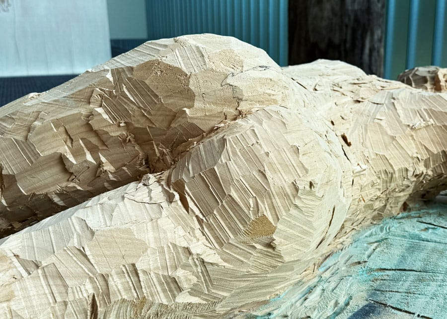 billen kont ass AIN anuskanker